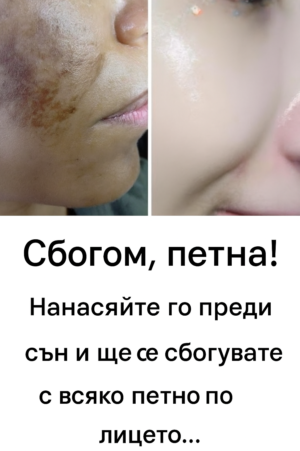 Тази маска се превърна в истинска сензация – тя ефективно премахва пъпките и несъвършенствата по кожата… 