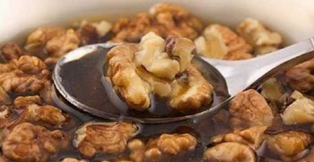 Почистване на кръвоносните съдове на мозъка с 5 ефективни метода