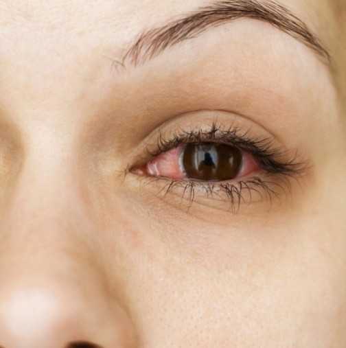 10 признака на тялото ви, които разкриват, че не сте здрави и не трябва да ги пренебрегвате, ако не искате да стигнете до фатален край